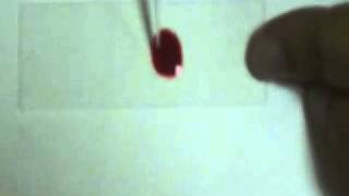 (Determination of clotting time) تعيين زمن التجلط