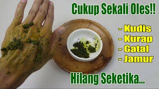 TAK USAH BELI SALEP MAHAL, CUKUP OLESKAN INI SEMUA JENIS GATAL PADA KULIT LENYAP