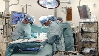 Serial Transverse Enteroplasty (STEP) - Boston Children's Hospital