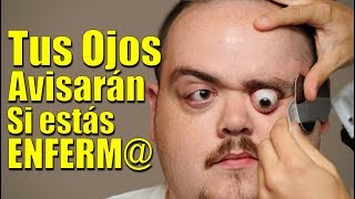 Tus Ojos te darán estas Señales y ALERTAS si Sufres Alguna Enfermedad | SALUDABLEMENTE TV