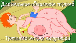 Длительное сдавление тканей. Травматическая ампутация - Неотложная помощь - Доктор Комаровский