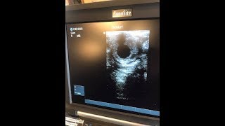 Pregnancy Announcement + Life update