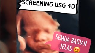 SCREENING USG 4D ! PLASENTA DIBAWAH?