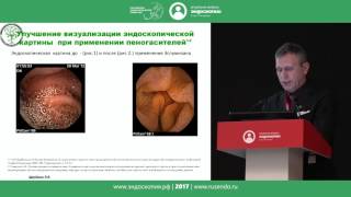Нюансы визуализации слизистой оболочки кишечника при капсульной колоноскопии