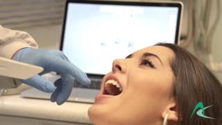 Sistema Cad Cam - Tecnologia para renovar seu sorriso