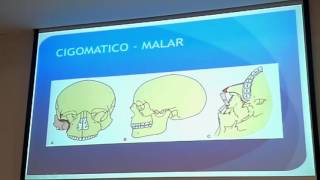 Fracturas Faciales Parte 1