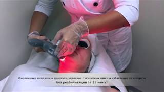 Омоложение лица,шеи и  декольте без реабилитации метро аэропорт