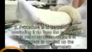 Long Leg Cast mp4video