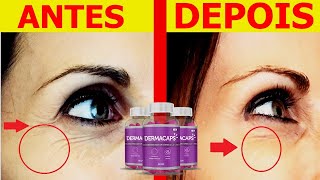DERMACAPS Funciona? DERMACAPS Antes e Depois? DERMACAPS é Bom? DERMACAPS Colageno? Funciona?