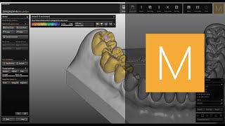 Zirkonzahn CAD/CAM Software-Module Prettau® (Fully Anatomic)