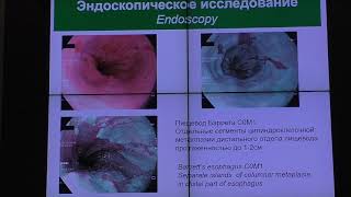 09Случай Видяева НС Пищевод Барретта после терапии ИПП