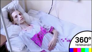 Анорексию можно будет лечить бесплатно при помощи ОМС