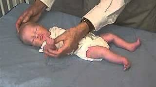 Clinical Pediatrics Hypotonia 1