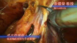 第四代達文西機器人手術簡介台語版 義大泌尿外科余燦榮教授