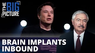 Brain Implants Inbound: In Musk We Trust?