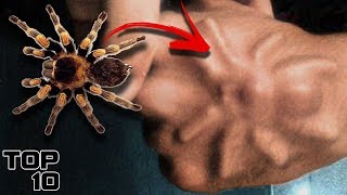 Top 10 Insane Life Saving Surgeries