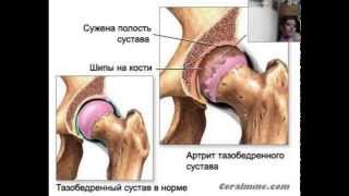 Опорно двигательная система и её здоровье