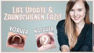 LIFE UPDATE + ENDLICH GERADE ZÄHNE? ? + veganer Food Haul & Essen ? VLOG