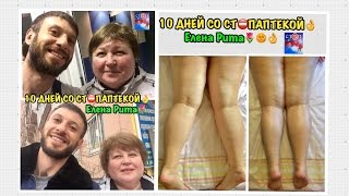 ЖИЗНЬ БЕЗ ТАБЛЕТОК И БОЛИ РЕАЛЬНА!