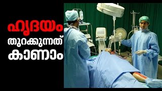 Open Heart Surgery Video | MEDex 2017 – Medical Exhibition |web special
