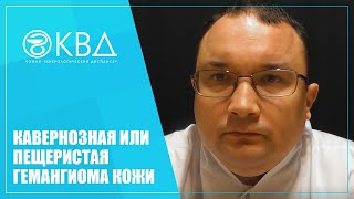 1327  Кавернозная или пещеристая гемангиома кожи