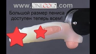 Протез «ONLOOG» Увеличение полового члена - индивидуально по вашим размерам! Без операции!