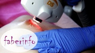 ЭПИЛЯЦИЯ волос на ГРУДИ у женщин. Гирсутизм