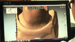 Sistema CAD/CAM BR3D - Dental