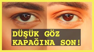 DÜŞÜK GÖZ KAPAĞIMDAN KURTULDUM ! EVDE BADEM GÖZ YAPTIM ?