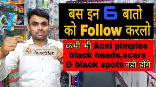#Acnestar gel for Acne,pimples and Black heads  ka hamesha k lye treatment||Explained by Mohd Arif