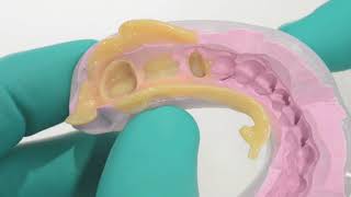 3M Protemp 4 Temporization Material