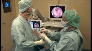 Balloon Dilatation of the Eustachian Tube