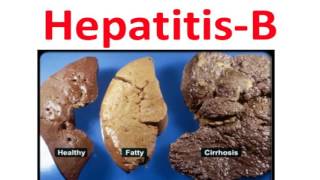 Hepatits B Vaccine Video MIC 419