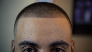 Bald fade with 2 on top