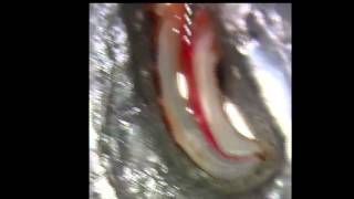 PathFile® - Dr. Gutmann | Dentsply Sirona