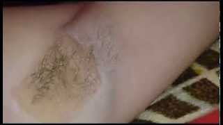 эпиляция подмышек. наглядное пособие/ Epilation