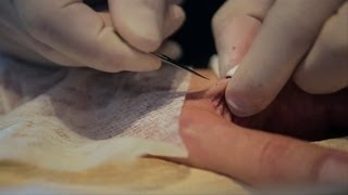 Watch Artist Implant a Net Art RFID Chip Into His Hand