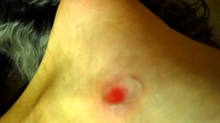 Dog licks wound