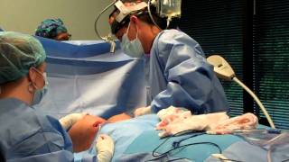 Breast Augmentation by Dr. Christopher Coley in Greensboro, NC