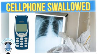 Prisoner Swallows Phone & Has to Have it Surgically Removed (ft. Silent Mike)