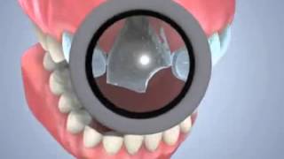 Clinique Dentiste Marrakech, Urgences 7j 7 et 24h 24, Chirurgie dentaire