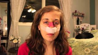 ♡ Nose Job Vlog: Part 1 ♡