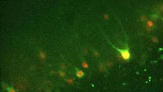 Viral labeling of live human neurons