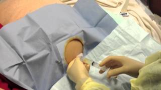 Paracentesis