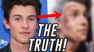 Shawn Mendes Scary Accident Explained