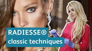 RADIESSE normal dilution, classic techniques performed by Dr. Olga Shvab