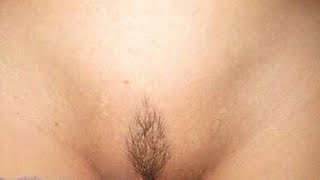 Most painful hair removal! Удаление волос навсегда. (Субтитры)