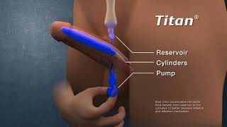 Coloplast Titan Animation 01