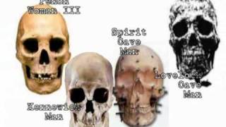 3 Basic Human Skulls