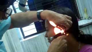 Ear Piercing-In Identical Twins - Dr Paulose FRCS (ENT)